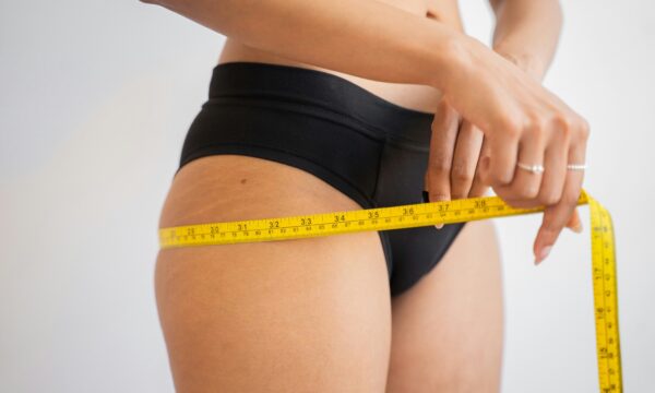 Lipedema e emagrecimento: entenda por que a perda de peso nem sempre reduz medidas nas pernas e braços